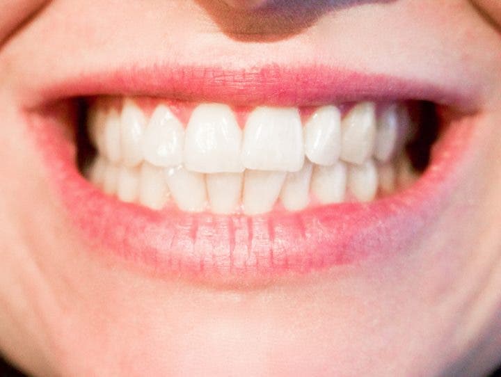 Hábitos saludables que están destruyendo tus dientes