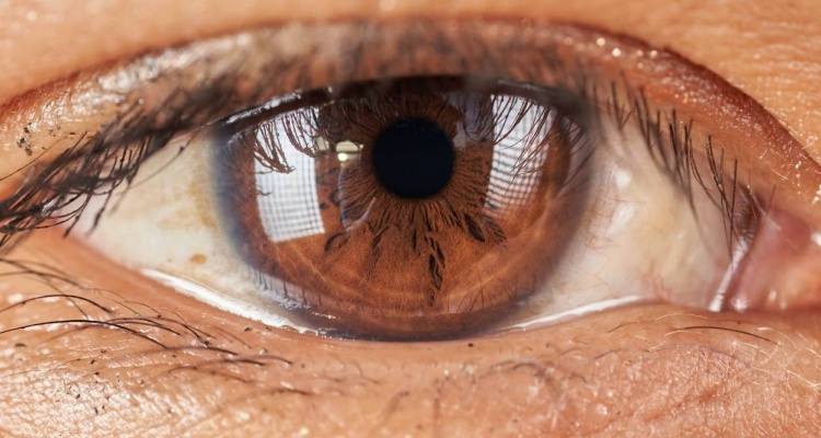Auge mit Augenausfluss