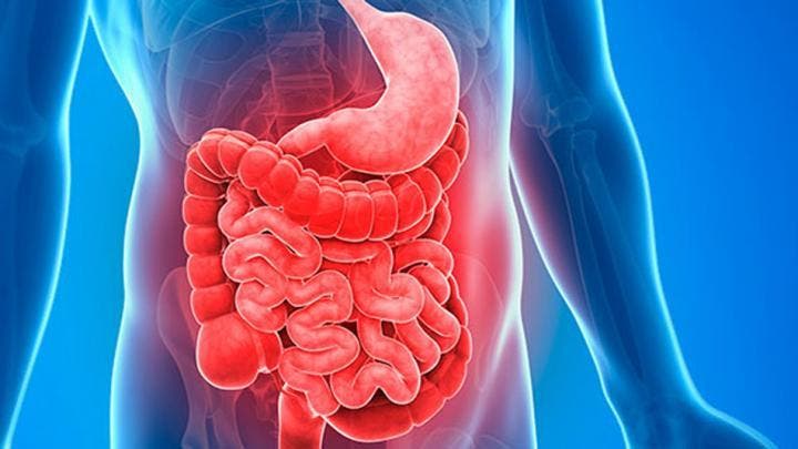 Plan para mejorar el síndrome del intestino permeable
